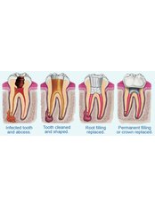 Anterior Canal - Boroimhe Dental Practice
