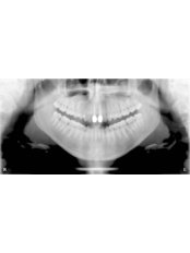 Digital Panoramic Dental X-Ray - Riverforest Dental Clinic