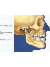 TMJ - Temporomandibular Joint Treatment - Riverforest Dental Clinic
