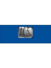 Digital Dental X-Ray - Riverforest Dental Clinic