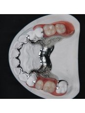 Chrome Dentures - Donabate Denture Clinic - Drogheda Clinic