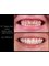 Dr. Thamer’s Smile Studio Dental Clinics - Madina Munwara St. Bld 219 office 208, Amman, Jordan, 11953,  15
