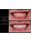 Dr. Thamer’s Smile Studio Dental Clinics - Madina Munwara St. Bld 219 office 208, Amman, Jordan, 11953,  11