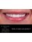 Dr. Thamer’s Smile Studio Dental Clinics - Madina Munwara St. Bld 219 office 208, Amman, Jordan, 11953,  13
