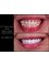 Dr. Thamer’s Smile Studio Dental Clinics - Madina Munwara St. Bld 219 office 208, Amman, Jordan, 11953,  12