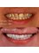 Dr. Thamer’s Smile Studio Dental Clinics - Madina Munwara St. Bld 219 office 208, Amman, Jordan, 11953,  14