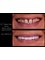 Dr. Thamer’s Smile Studio Dental Clinics - Madina Munwara St. Bld 219 office 208, Amman, Jordan, 11953,  7
