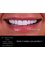 Dr. Thamer’s Smile Studio Dental Clinics - Madina Munwara St. Bld 219 office 208, Amman, Jordan, 11953,  16