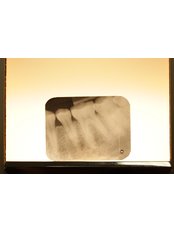 Dental X-Ray - Privat Dental Clinic ComfortDent