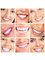 Ayoub Dental Clinic - Hollywood Smile 