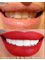 Hollywood Smile Dekwaneh - hollywood smile beirut lebanon dental clinic dentist 