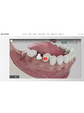 Immediate Implant Placement, ceramic Swiss Dental Solutions (SDS) - Auksteja, UAB