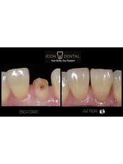 Cosmetic Dentistry  - Icon Dental Clinic