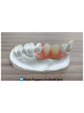 Flexible Partial Dentures - Klinik Pergigian  Dr. Karthi