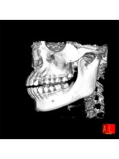 3D Dental X-Ray - Klinik Pergigian Dr. Karthi