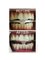 Elements Dental Clinic - Tooth whitening treatment 