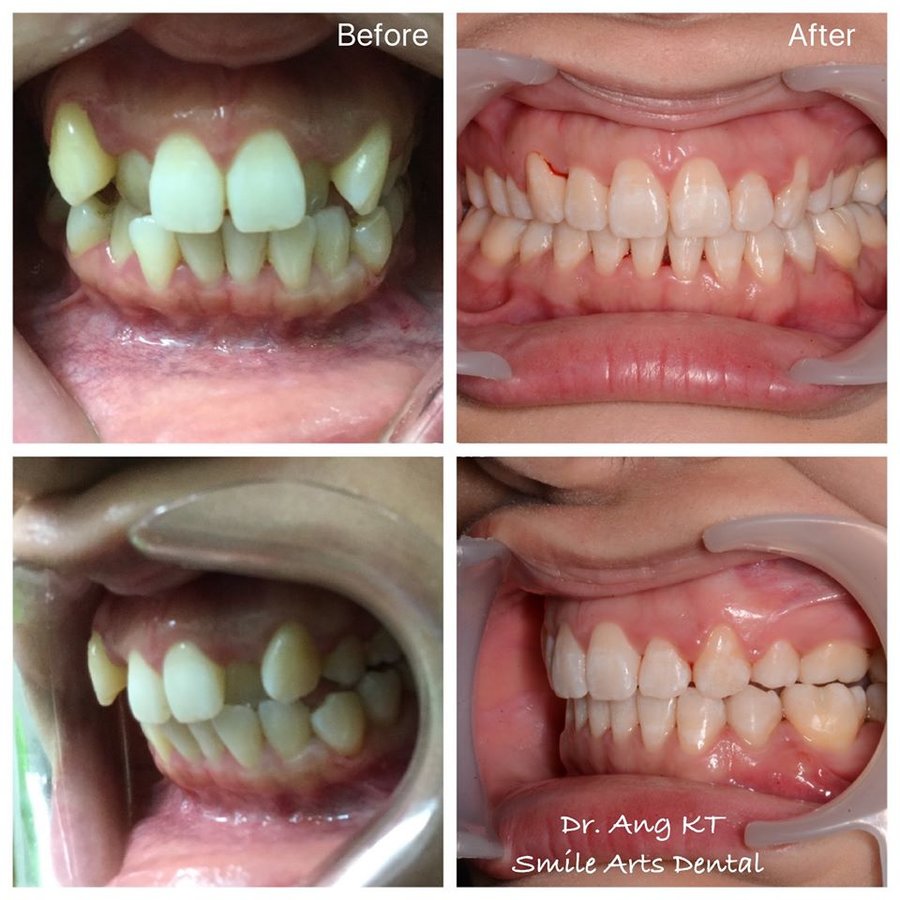 Smile Arts Dental Clinic in Petaling Jaya, Malaysia • Read