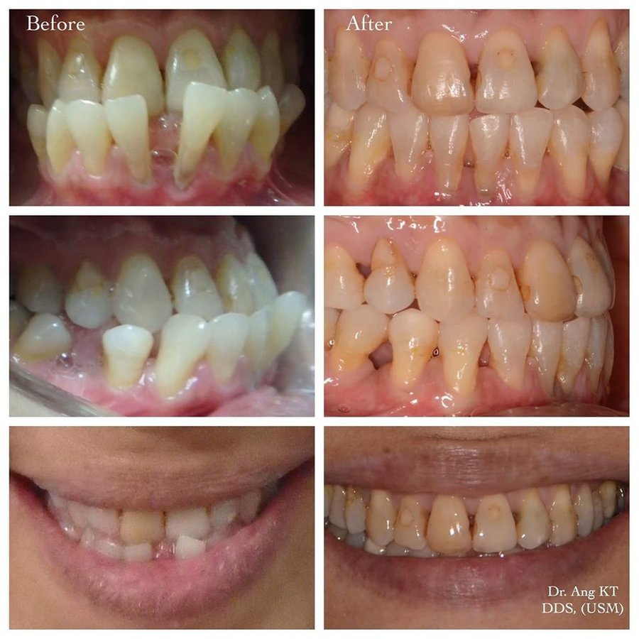 Smile Arts Dental Clinic in Petaling Jaya, Malaysia • Read