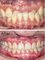 V DENTAL CLINIC SS2 - Before and After 