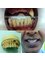 Dr Teeth Dental Clinic - Bridge, Crown, Veneer and Denture 