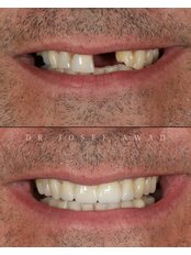 Dentist Consultation - Pearl Dental Clinic