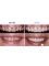 Dr. M. Dussoye Dental Clinic - Maheswar Nagri Road,, 9th Milestone,, Triolet, Pamplenousses, 21504,  5