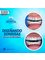 Consultorio dental García - Dental bridge 