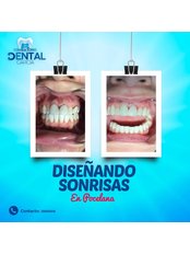 Dental Venner - Consultorio dental García