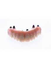 Immediate Dentures - Dental Design Studio Cancun