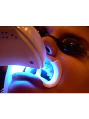 Laser Teeth Whitening - Dental Office Cancún