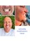 LuDentistry - Dentalmakeover with zirconia crowns in Cancun, Mexico 
