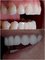 Neo Dental Cancun - Before & After 