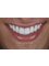 Smile Now Dental & Facial Care - Avenida Tulum, Plaza San Francisco Local 303 SM 11 Mz1 Lote1, 77504 Cancún, Q.R., Cancun, Quintana Roo, 77504,  0
