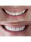 Smile Now Dental & Facial Care - Avenida Tulum, Plaza San Francisco Local 303 SM 11 Mz1 Lote1, 77504 Cancún, Q.R., Cancun, Quintana Roo, 77504,  2