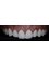 im.perio Dental - Teeth whitening  