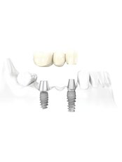 CAD/CAM Dental Restorations - ImplArt Dentistry®