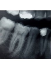 Dental X-Ray - Jabal Dental
