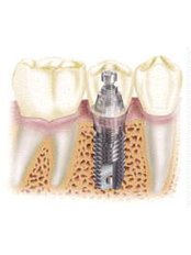 Dentist Consultation - California's Dental Care