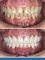 Capital Dental Care - Before and After 