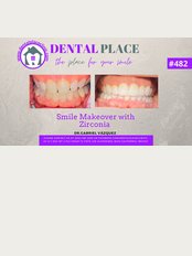 DENTAL PLACE - Call to get a free evaluation +1928-287-0132