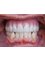 Marietta Dental Care - All-On-4 