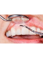 Teeth Cleaning - Molina's Dental Office