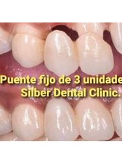 Dental Bridges - Silber Dental Clinic