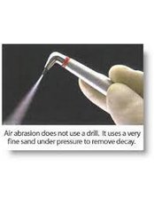 Air Abrasion - Solis Oral Care Center