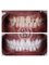 Supreme Dental Clinic - Full Mouth Rehab with 28 Zirconia Crowns 