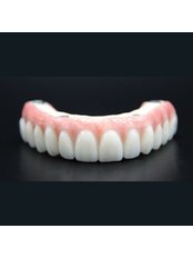 Immediate Implant Placement - The All on X Dental Studio