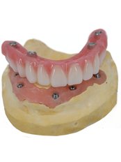 Immediate Implant Placement - The All on X Dental Studio