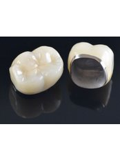 PFM Crown - Unik Specialized Dentistry