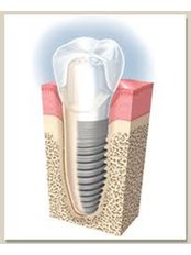 Implant Dentist Consultation - Dental Implantology Unit at CMA Hospital