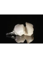 Single Implant - Dental Implantology Unit at CMA Hospital